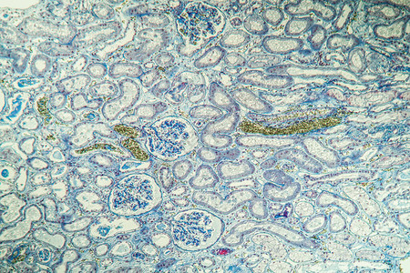 肾脏中的纤维素沉积显微镜检图片