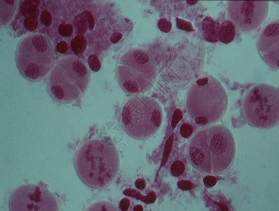 细胞核中的染色体图片