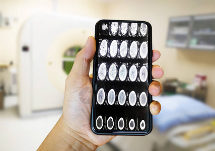 医生使用智能手机检查了大脑扫描图片