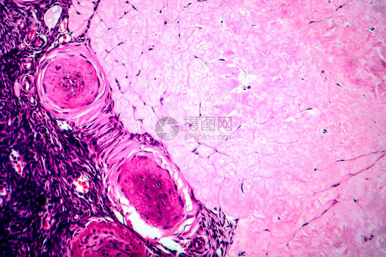 卵巢滤泡囊肿光学显微照片显微镜下照片图片