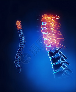 颈椎解剖细节图片
