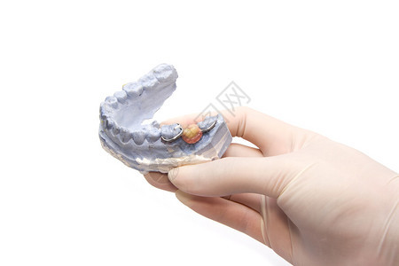石膏模型石膏上的牙科假牙加上图片