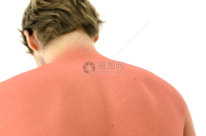 在人类的皮肤上，有时会留下一些独特的印记，它们不仅记录着外伤的痕迹，也似乎蕴含着某种深层的心理密码。本文将尝试从医学和相学的双重视角，探究烧伤再生纹背后的秘密，揭示其与潜在的人格分裂的联系，并对相关理论进行探讨。