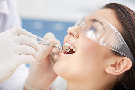 在牙医诊所口腔检查时对张开嘴的女孩图片