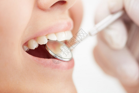 牙医口腔检查时人张嘴的特写图片