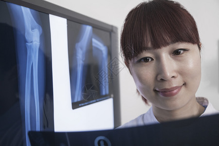 微笑的女医生看着人体骨骼的X光片图片