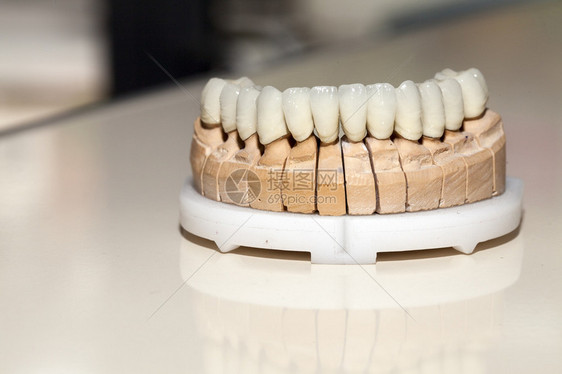 牙医店的锆瓷牙盘图片