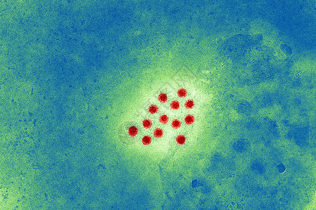显微镜下的肝炎图片