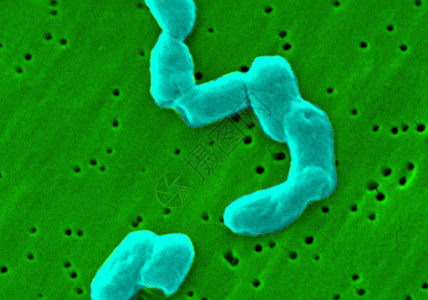 显微镜下的沙门氏菌图片