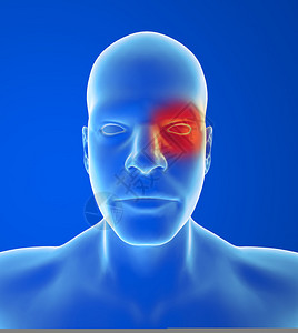 头痛类型群类疼痛在蓝色背景的一图片