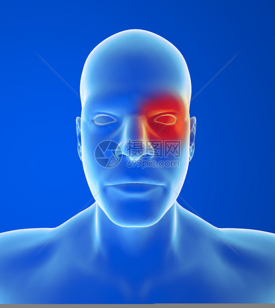 头痛类型群类疼痛在蓝色背景的一图片