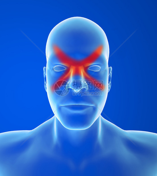 头痛类型西努斯疼痛通常在前额后面图片