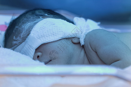 新生婴儿在蓝色紫外线光下携带新生儿黄蜂图片