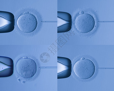 人工受精图片