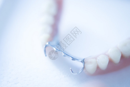 可移除的部分假牙金属和塑料牙齿图片