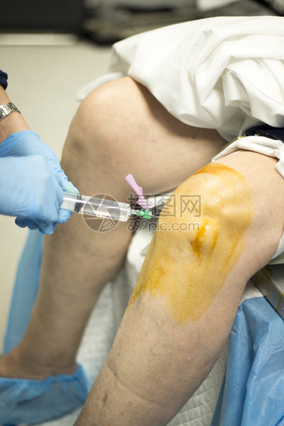 在医院急诊室手术室对腿部照片进行绝育手术时图片