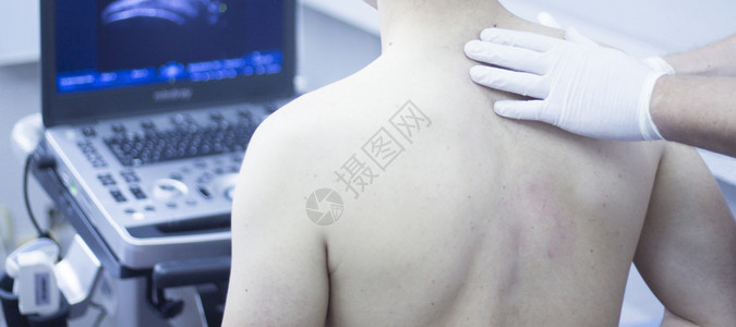 超声辅助生态学组织内经皮电解肩部诊断在医疗中心IPE理疗诊所理背景图片