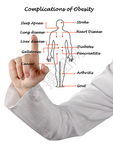 肥胖并发症示意图图片