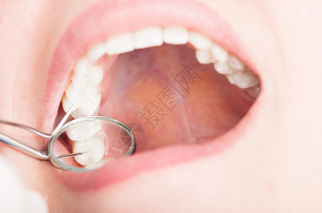 关闭牙科检查用牙镜对美丽的白人妇女牙齿图片
