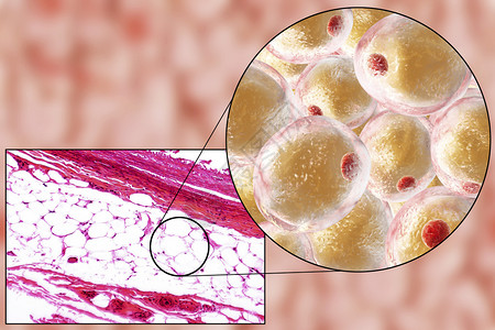 放大100倍脂肪细胞脂肪细胞有大的脂滴图片
