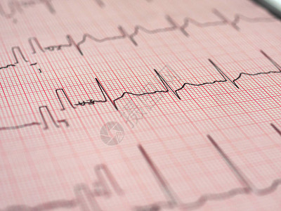 心电图ECG又名EKGElektrokardiogramm测量心跳图片