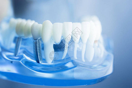 牙齿科学生习教学模型显示牙齿牙根牙龈牙龈疾病图片
