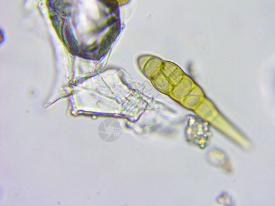 粉尘和微生物显微视图x10图片