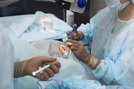 超声乳化超声破坏不透明晶状体眼科手术人工晶状体置换人工晶状体安装白图片