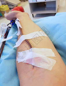 一位慷慨的志愿者献血者的手臂医院的图片素材