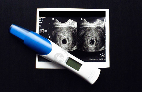 怀孕测试背景上的对象图片