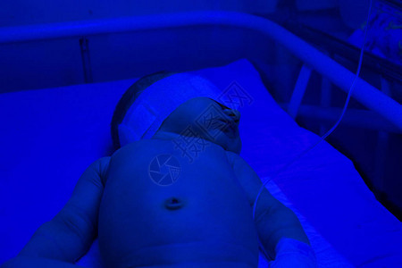 在医院治疗黄疸的新生儿光疗背景图片