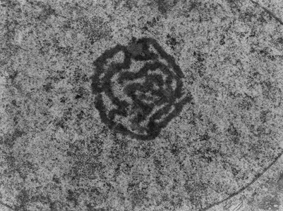 显示核仁的透射电子显微镜TEM显微照片纤维成分显示为称核仁的厚盘绕细丝图片