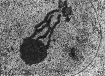 透射电子显微镜TEM显微照片显示精母细胞中的囊图片