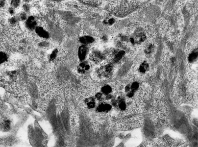 假的彩色传输电子显微镜TEM显微图显示皮肤上皮细胞中的米拉宁颗粒图片