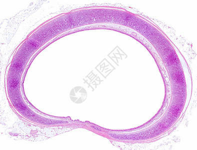 气管的横截面图片