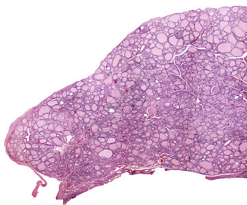 显示人类甲状腺的低倍显微照片甲状腺实质由许多充满胶体的滤泡组成光学显微镜显微照片苏木精图片