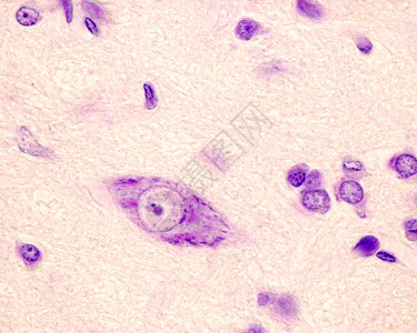 用甲酚紫染色的神经元显示位于大核仁附近的Barr体图片
