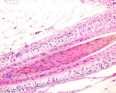 纵向剖面中人类毛囊的层数图片