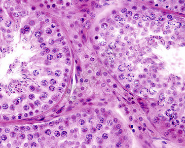 间质或间质细胞位于曲细精管之间的结缔组织中图片