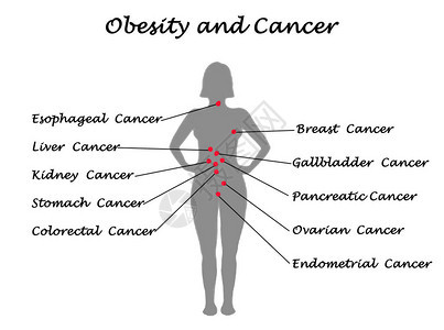肥胖作为许多癌背景图片