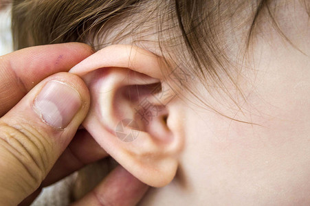 冬季使许多儿童耳朵中耳感染和婴儿医疗迅速发炎图片