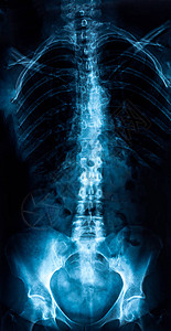 妇女后备箱X光脑图片