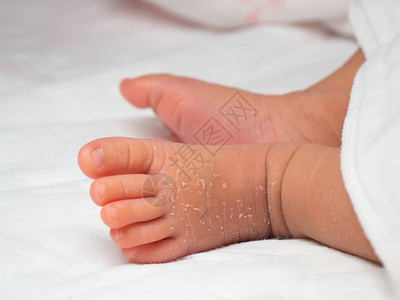 在白布上剥皮的新生儿脚或足部近距离关紧图片