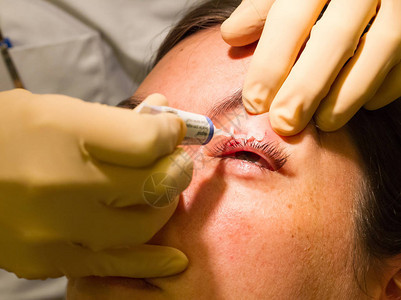 医疗保健概念眼药眼科检查和手术中的图片