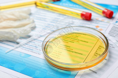 桌上有尿样和测试表格的玻璃盘泌尿科概念图片
