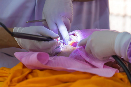 医生用超声波工具给病人洗牙背景图片
