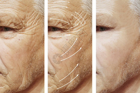 人脸上的皱纹在程序图片