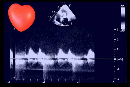 超声波图像和小心脏回声心动机屏幕图片