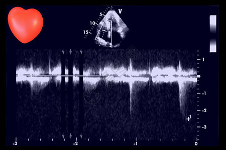 超声波图像和小心脏回声心动机屏幕图片
