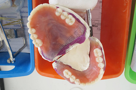 牙科实验室建设牙科印象图片
